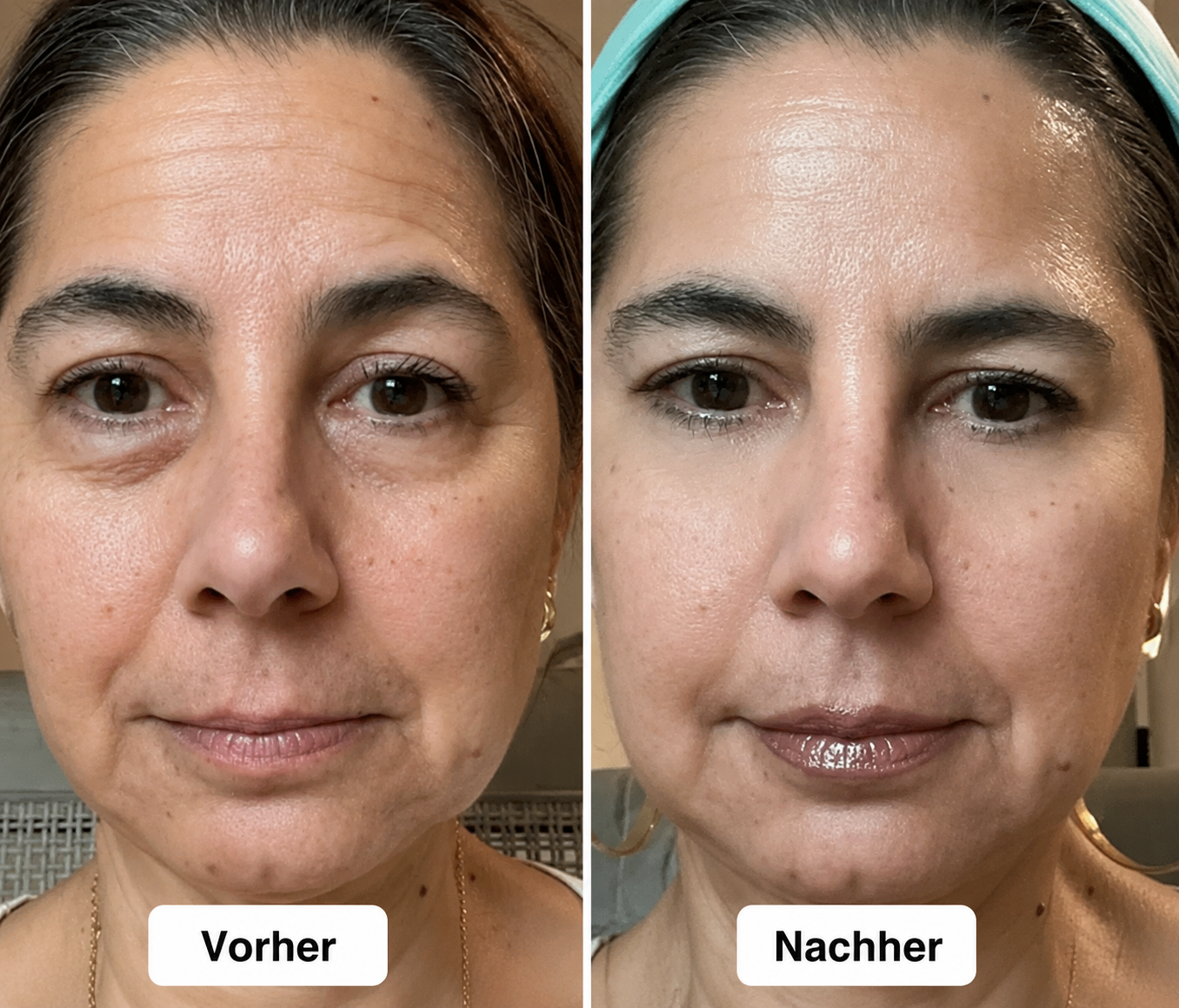2-in-1-Rotlichttherapie
