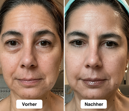 2-in-1-Rotlichttherapie