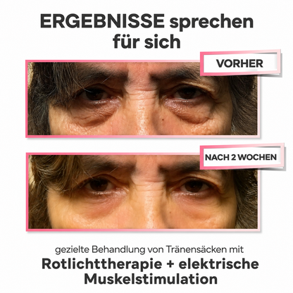 2-in-1-Rotlichttherapie