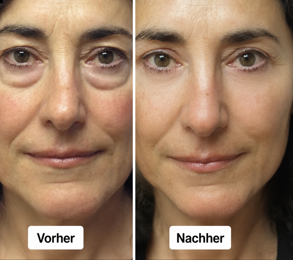 Vorher / Nachher Arlene W.