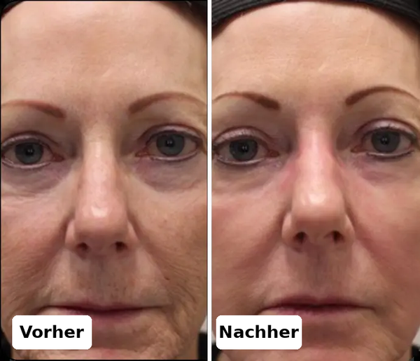 Vorher / Nachher Gabrielle P.