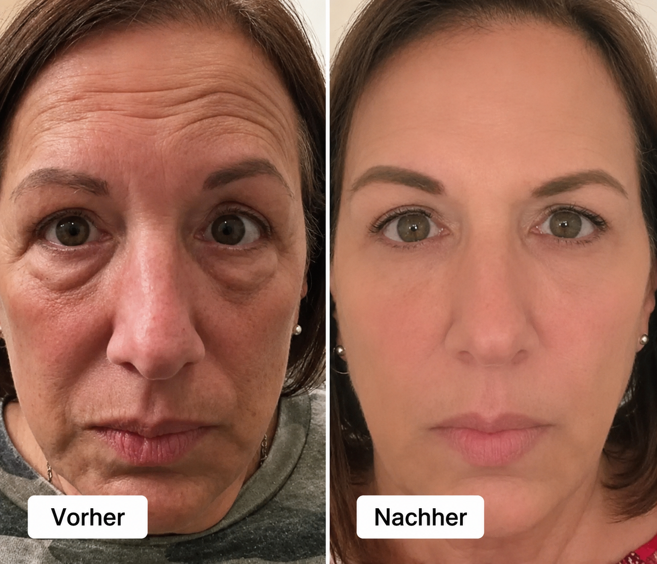 2-in-1-Rotlichttherapie