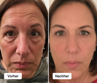 2-in-1-Rotlichttherapie